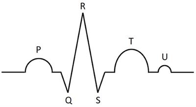 Interpretable Feature Generation in ECG Using a Variational Autoencoder